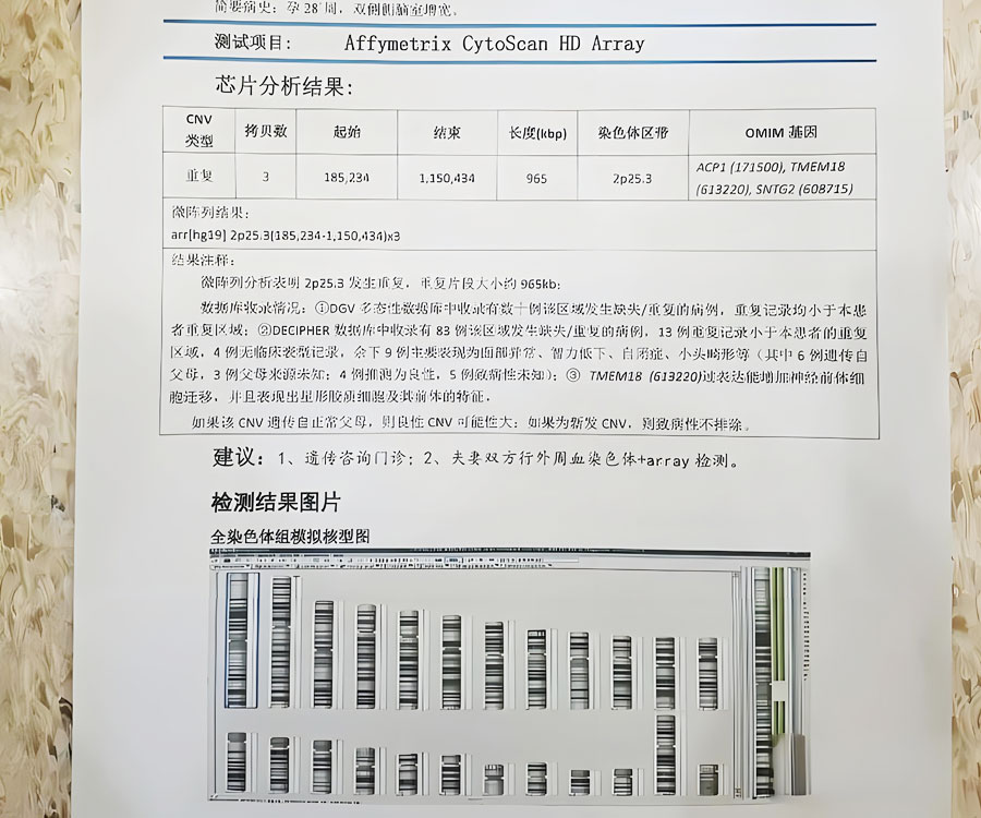 胎儿染色体异常