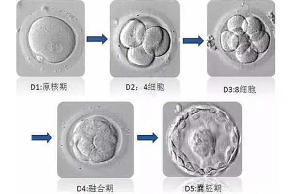 0-3PN胚胎移植攻略